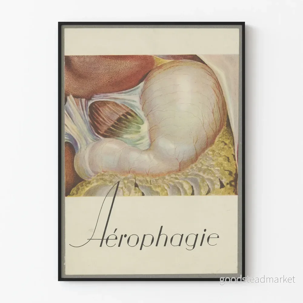 Vintage medicinsk poster om aerofagi med anatomisk illustration